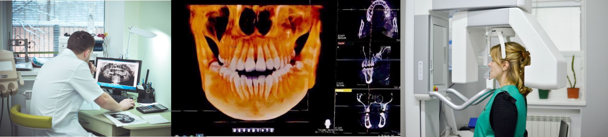 Панорамный снимок члюсти